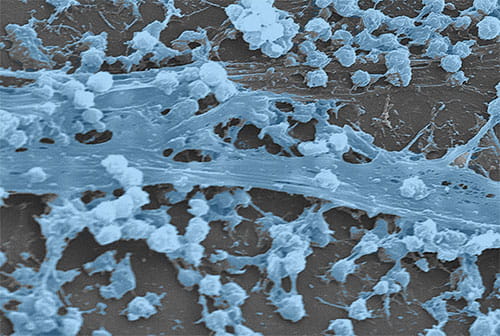 Staphylococcus aureus biofilm that has formed on an indwelling catheter (CDC Public Health Image Library).